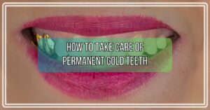 How to Take Care of Permanent Gold Teeth